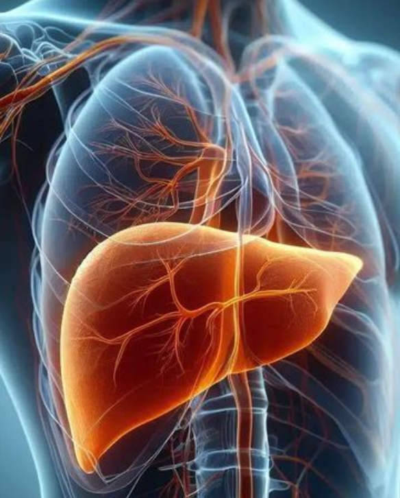 Additional Cirrhosis Illustration